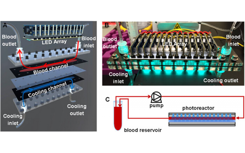 微流控光反應器治療新生兒黃疸